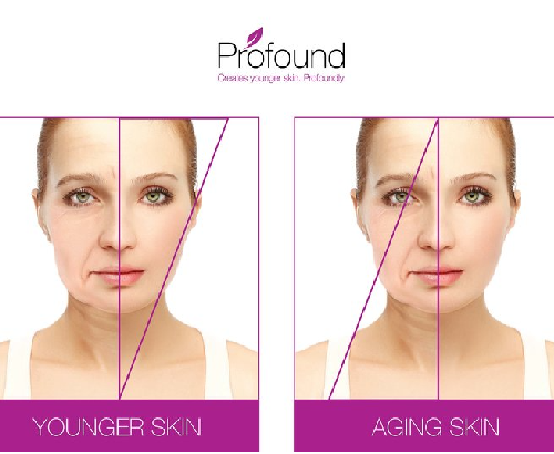 profound skin tightening treatment