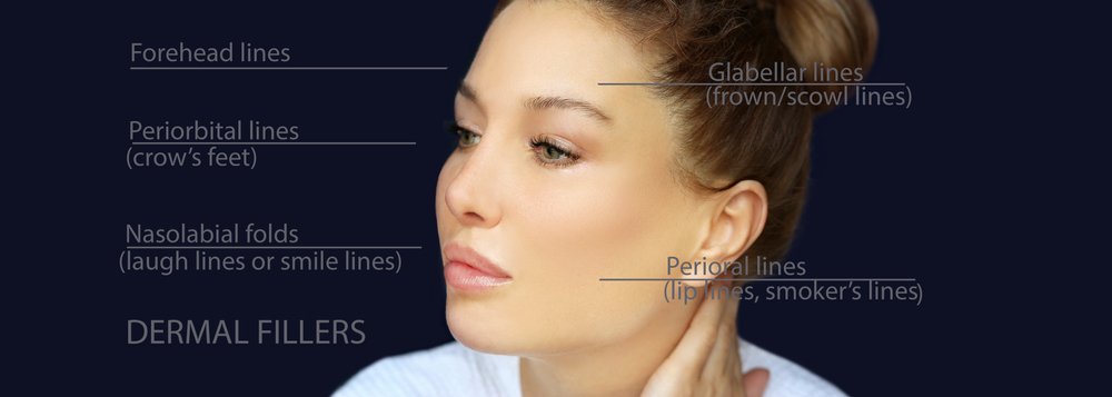 dermal fillers treatments