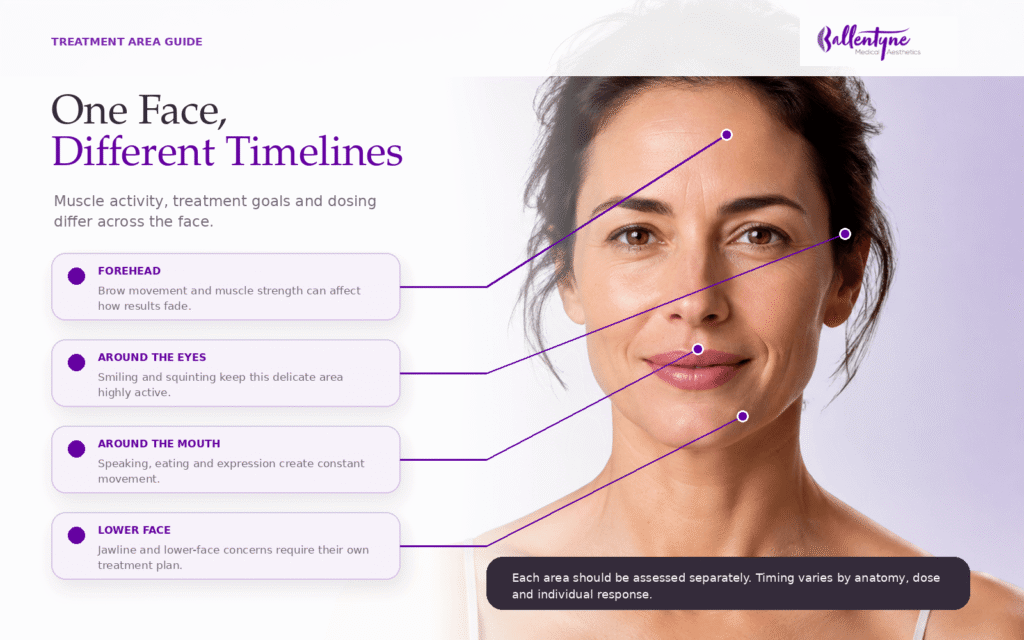 Botox Treatment Area Guide